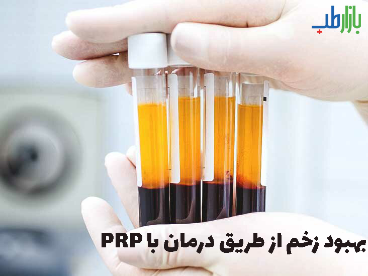 درمان زخم با PRP