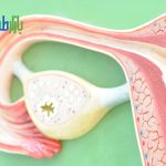 عدم تعادل هورمونی
