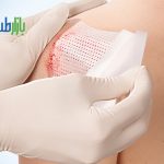 پانسمان های جدید در مراقبت از زخم