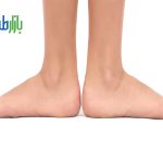 پیشگیری از زخم پای دیابتی