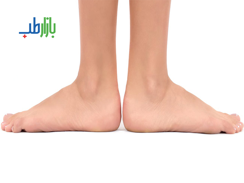 پیشگیری از زخم پای دیابتی