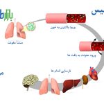 سپسیس