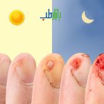 زخم روز