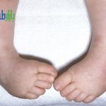 پا چنبری