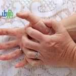 خارش اگزما