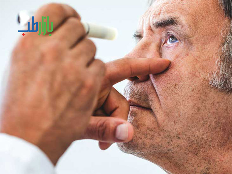 رتینوپاتی دیابتی