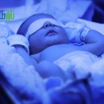 مزایای فتوتراپی