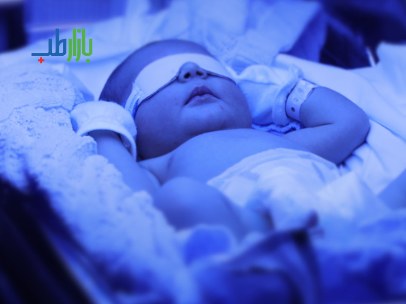 مزایای فتوتراپی