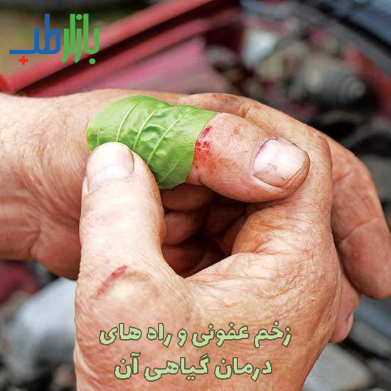 درمان گیاهی زخم عفونی