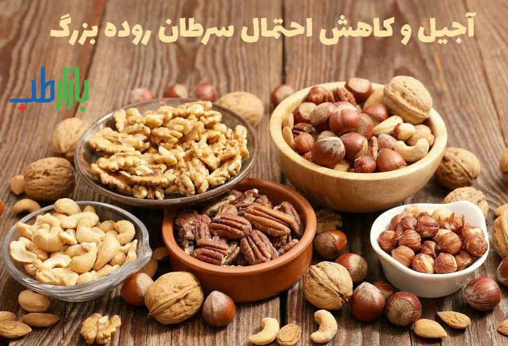 آجیل و سرطان روده