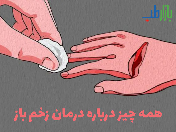 درمان زخم باز