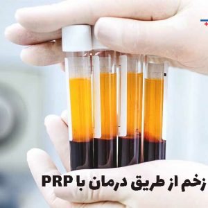 درمان زخم با PRP