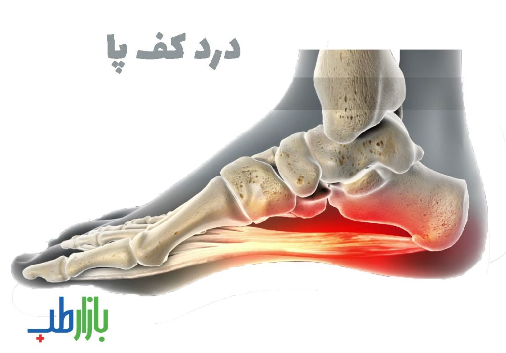 درد کف پا