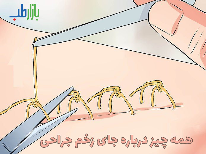 جای زخم جراحی