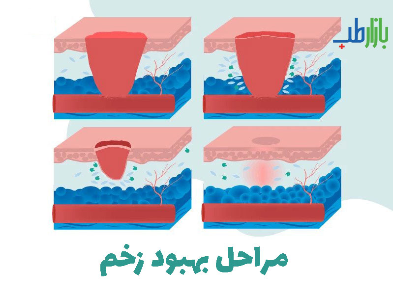 بهبود زخم
