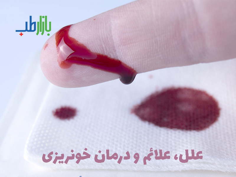 درمان خونریزی