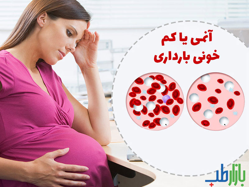 کم خونی بارداری
