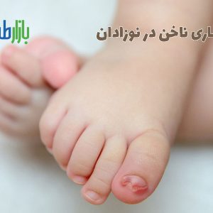 بیماری ناخن در نوزادان