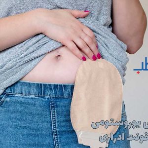 جراحی یوروستومی