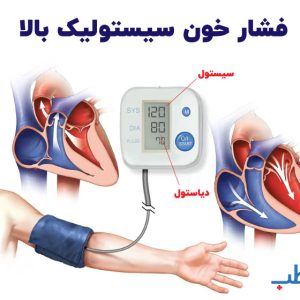 فشار خون سیستولیک