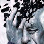 بوتاکس برای مغز