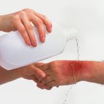 کارهای درست یا غلط مراقبت از زخم