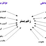 درمان زخم فشاری
