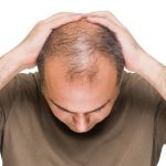 با این روش ها از ریزش مو جلوگیری کنید